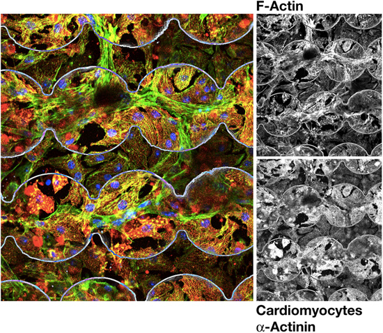 IF image of cardiomyocytes on electrodes